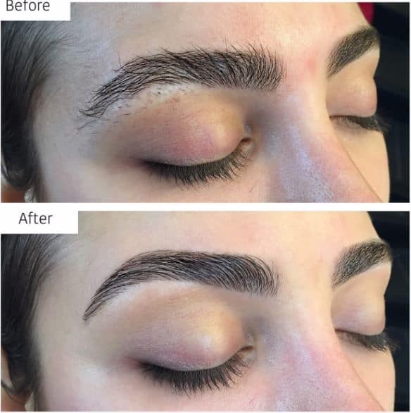 photo of cosmetic tattoo eyebrow melbourne
